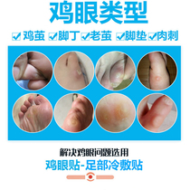 Tongrentang chicken eye paste correction special artifact toe warts special medicine plantar wart net Yam Shuang King Chicken Eye paste