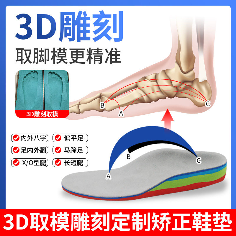 远足儿童扁平足矫正鞋垫内八字订制3D足外翻XO腿宝宝足弓支撑垫