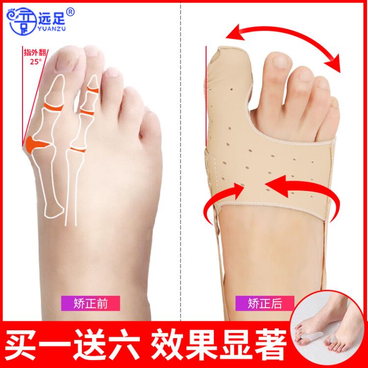 Hiking hallux valgus orthosis female adult thumb valgus big foot bone female anti-children day and night toe corrector