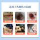 Bailing Jinfang Wound Spray Dog Interdigital Inflammation Wound Healing Trauma Reduce Swelling Dog and Cat Neutering Myogenic Antibacterial Liquid