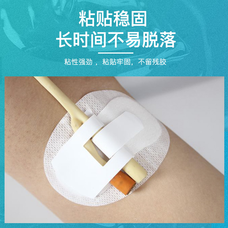 держатель катетера бибар. пластырь tegaderm 3m для катетера. ремень держатель для катетера фолея. фиксация катетера внутривенного. фиксации катетера.