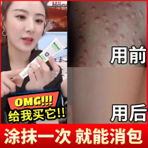 Mosquito mosquito bites itching swelling and swelling ointment for baby children and babies