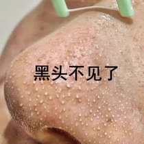 Buy 2 get 1 free ~ Let the pores expel dirt like spitting sand and remove 99% of facial pore garbage