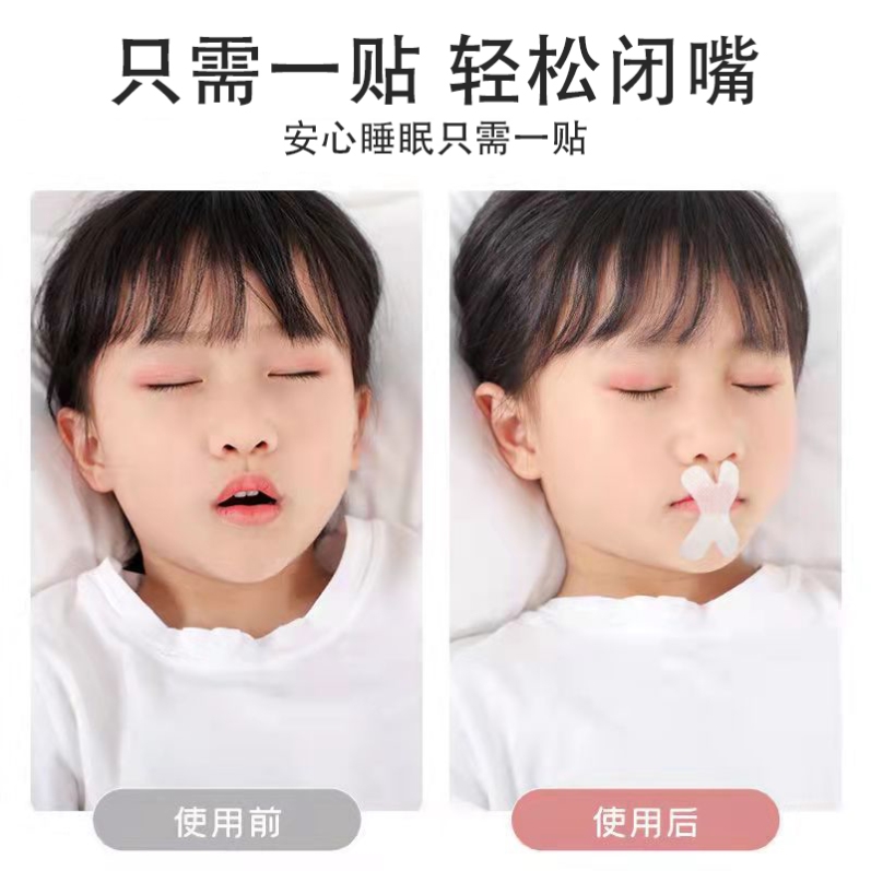 Lips Upped Aligner Glands BODY HYPERTROPHY FACE STRAIGHTENER CHILD STICKUP LIPS THEORIZER CLOSURE SHUT UP SHITZER