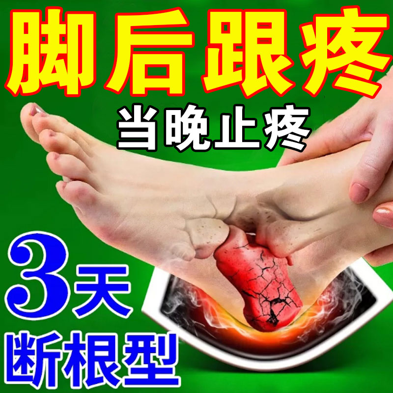 (Heel and sore night good) heel pain theorist heel tingle with bone pain special medicine plantar fasciitis paste-Taobao