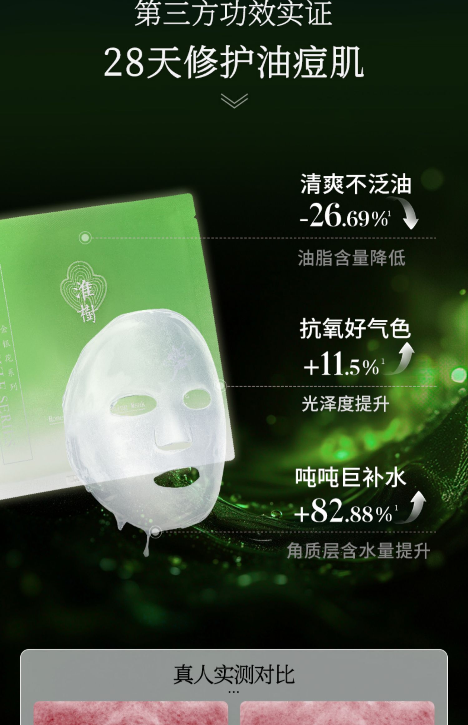 淮树金银花清颜面膜补水保湿控油祛痘淡化痘印平衡水油