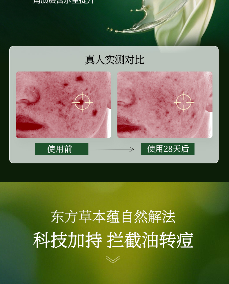 淮树金银花清颜精华液60ml 祛痘保湿修护补水控油正品化妆品官方旗舰店