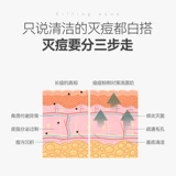 Очищающее молочко, масло для удаления угрей, средство для удаления прыщей подходит для мужчин и женщин, анти-акне, контроль жирного блеска, содержит лошадиное масло, официальный продукт