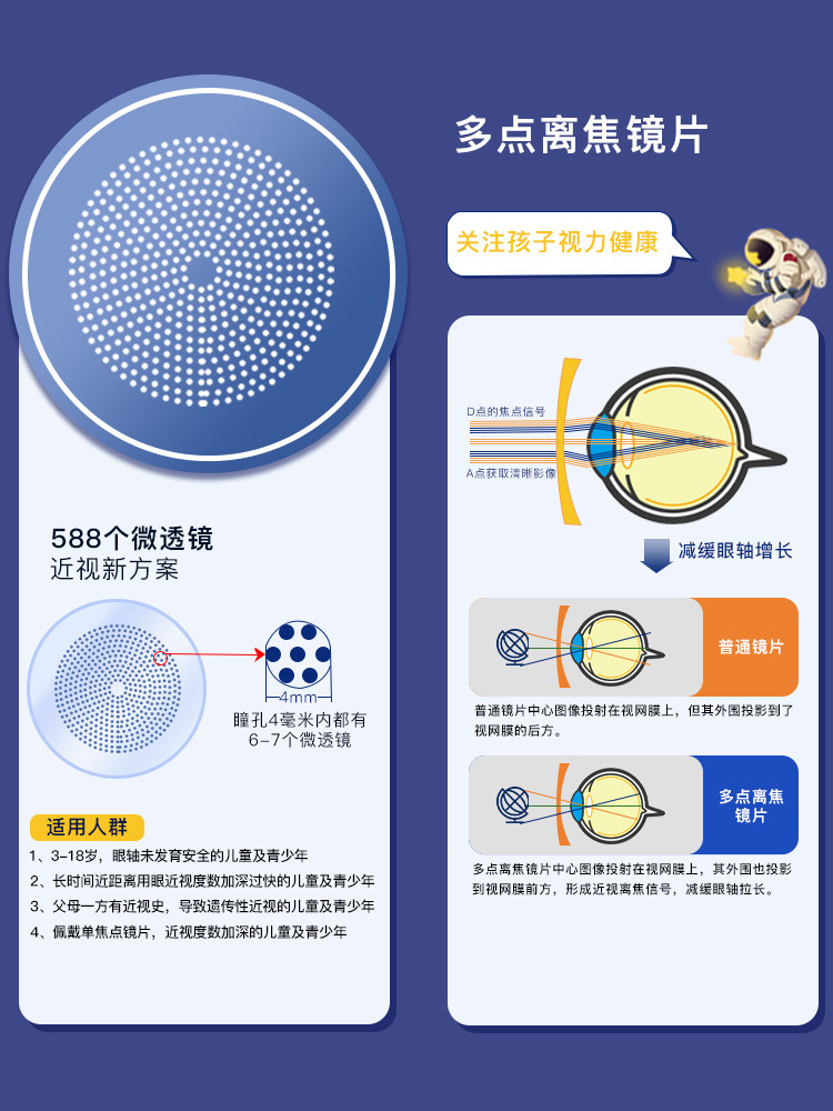 Multifocal Peripheral Defocus Control Myopia Glasses Lenses for Children to Protect Vision, Teenagers and Primary School Students with Increasing Degree of Myopia
