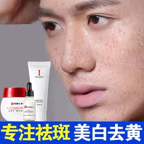 Renhe freckle artifact mens freckle cream special spot whitening light spot chloasma freckle facial skin care products to buy