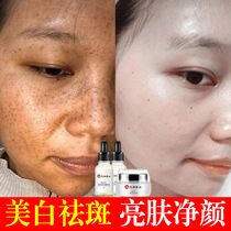 Renhe freckle cream whitening light skin care set freckle genetic spot whitening artifact men to buy