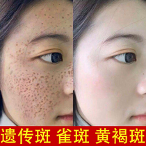 Tongrentang whitening freckle cream freckle genetic spots remove melanin artifact old domestic products fade color spots to buy