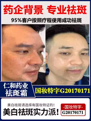 Renhe freckle artifact men's freckle cream special spot whitening light spot chloasma freckle facial skin care products to buy