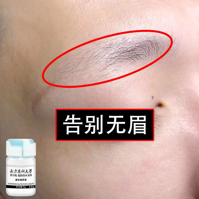 Xiaohongshu recommends eyebrow nourishing liquid goodbye to no eyebrow nourishing liquid for men who have wild eyebrows quickly buy two get one free
