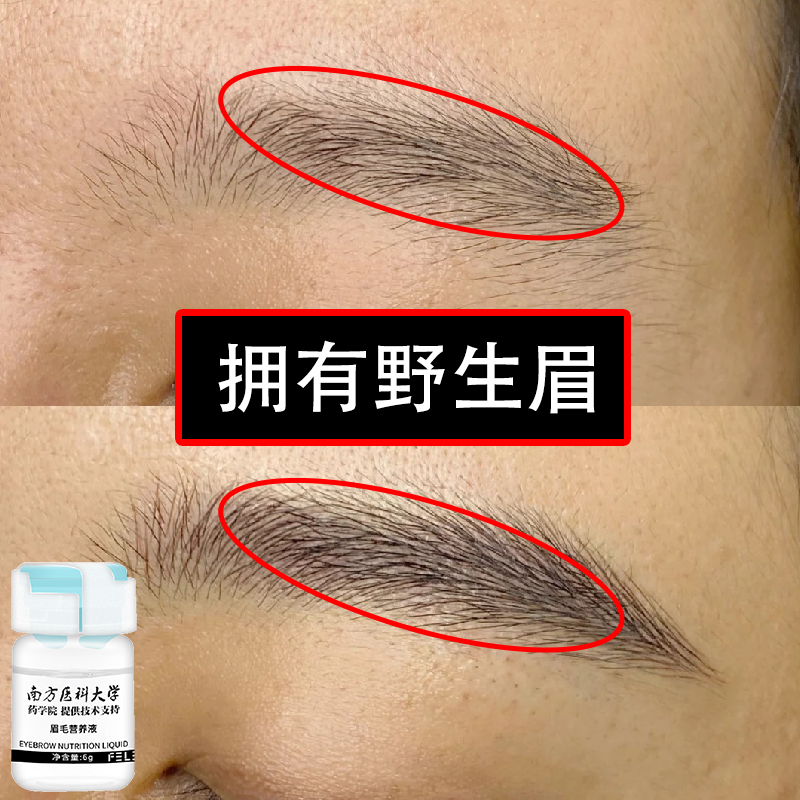 Store length Recommended brow nourishing liquid fast with wild brow Farewell eyebrow Brow Brow nutrient solution Buy two and send one