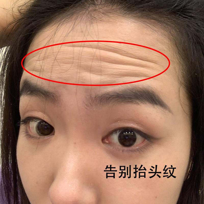 Little red book recommends anti-wrinkle paste goodbye to downplay the Sichuan lithography artifacts Buy 2 to 1