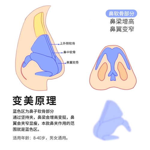 Увеличение носа, чтобы стать носовым артефактом моста, формируя нос, чтобы уменьшить нос, нос, нос.