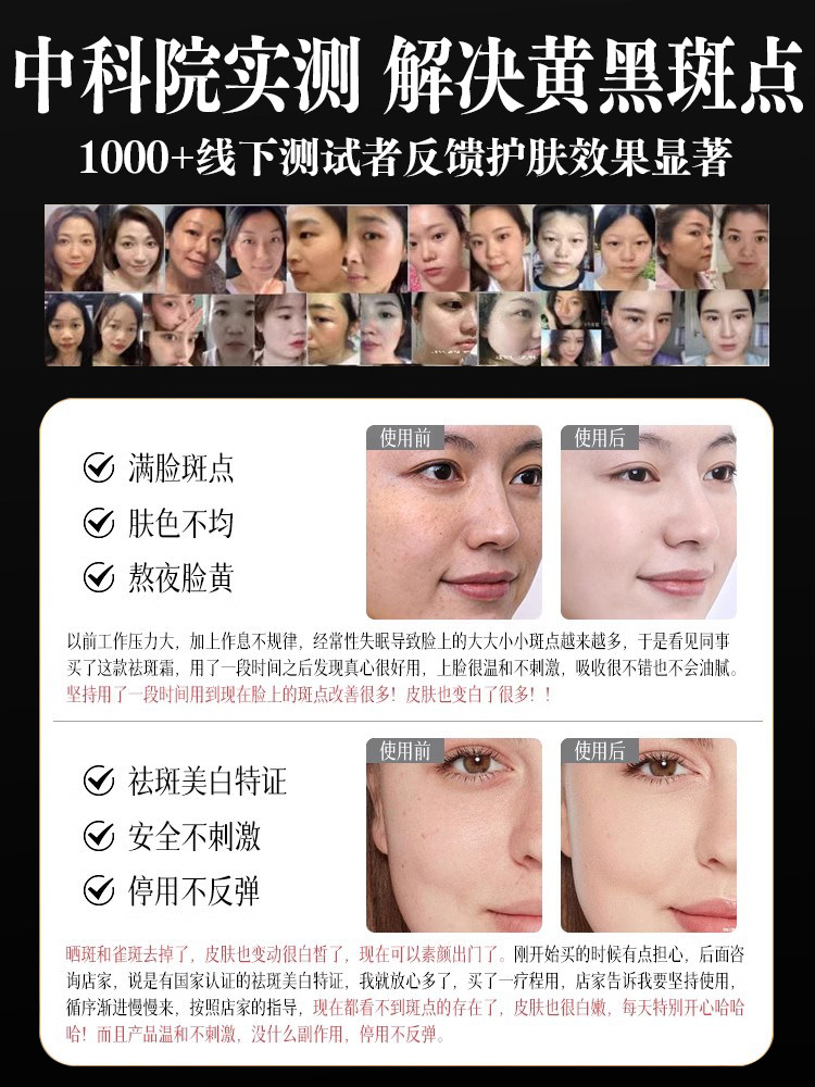 Black Bandage Whitening and Freckle Removal Cream, Niacinamide, Removes Chloasma, Age Spots, and Freckles, Special Morning and Night Cream, Official Authentic Product