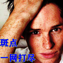 Renhe whitening freckle cream and freckle artifact for mens special defactions for senile plaques special hand face