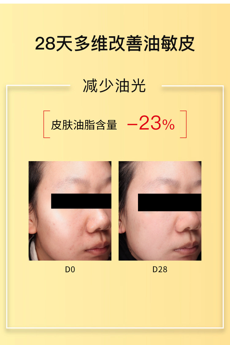 【香港直邮】 John Jeff 姜黄精华液30ml 敏皮专研抗氧|4%姜黄素+2%油橄榄 |褪红提亮双效 |控油不拔干 |熬夜暗沉救星