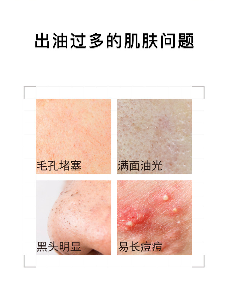 Лосьон/лосьон john jeff水杨酸水控油抑制油脂痘皮油皮毛孔爽肤水化妆水姐夫