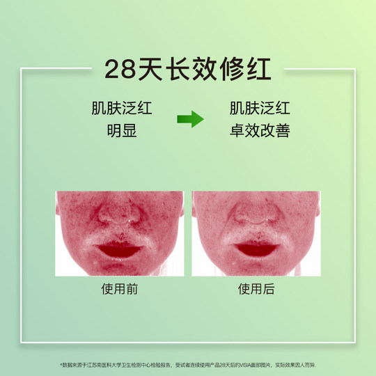 John Jeff Olive Essence (версия для кожи с прыщами) устраняет покраснения, улучшает покраснения кожи, успокаивает свекруху