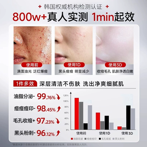 Мужское очищающее молочко на основе аминокислот от черных точек, анти-акне, контроль жирного блеска, сужает поры