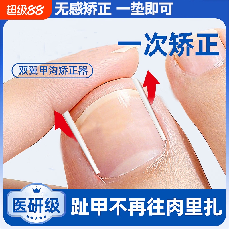 Nail Groove Correction Tool, Nail Correction Device, Ingrown Toenail Correction Pad, Toenail Growth into Flesh Filling Pad, Cotton