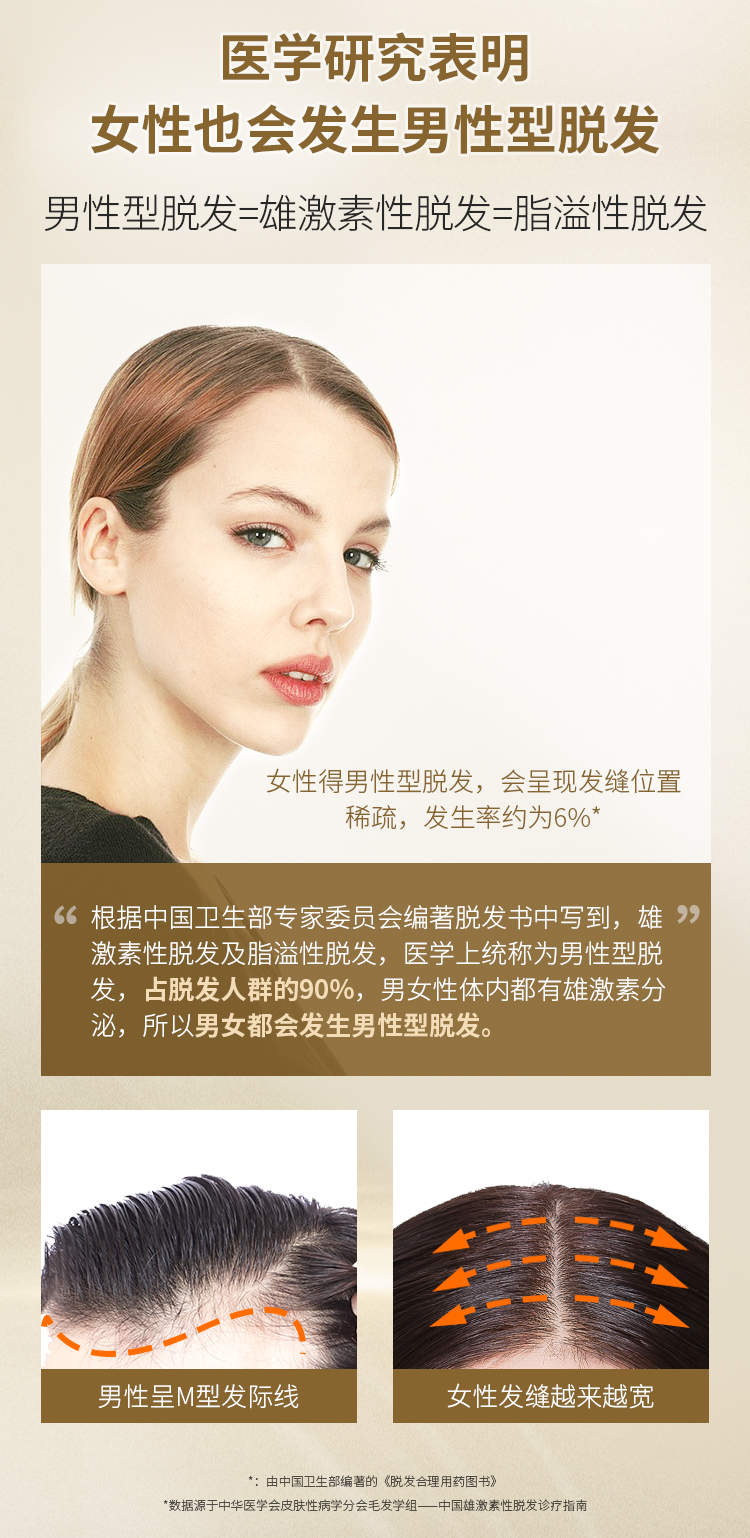 真有效的国药OTC 蔓迪 米诺地尔酊 女性防脱生发喷剂 30ml 图4