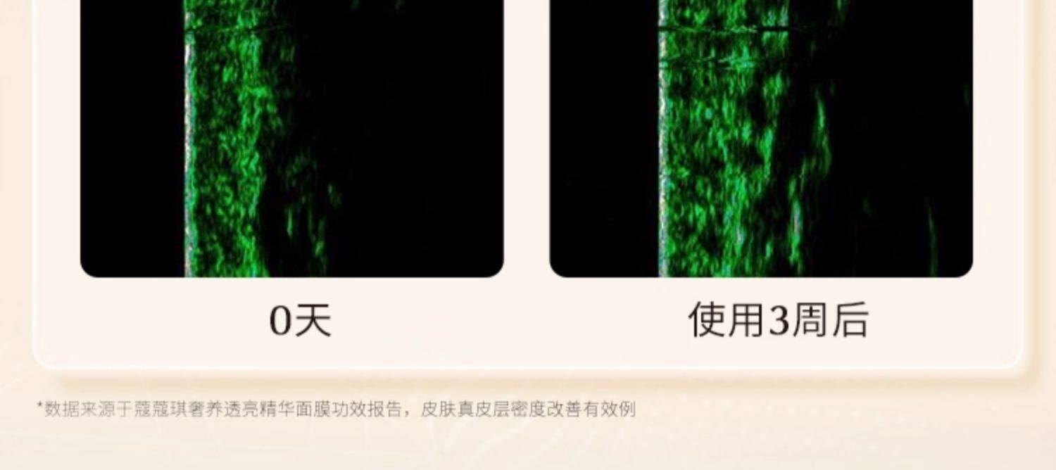 【香港直郵】 日本 COCOCHI 第三代AG抗糖mini小金罐面膜 18g✖️5 3.0升級版 緊緻保濕 旅行便攜裝