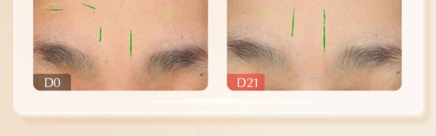 【香港直郵】 日本 COCOCHI 第三代AG抗糖mini小金罐面膜 18g✖️5 3.0升級版 緊緻保濕 旅行便攜裝