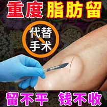 Lipoma removal artifact Whole body subcutaneous anti-patch multiple herb anti-tumor cream to eliminate hard lump Chinese herbal medicine