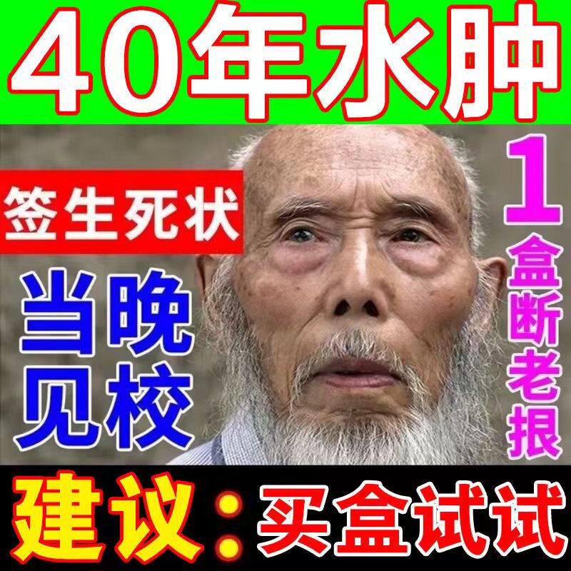 (Elderly foot edema) edema paste to remove edema, swelling of the body, thigh feet, lower limbs, edema and edema