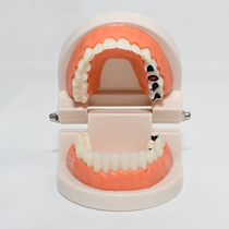 Dental dentures dental dental brushing model childrens learning demonstration kindergarten childrens teaching aids mold