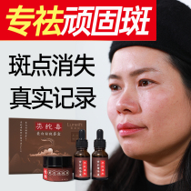  Lu Ning Fei whitening freckle cream Light spots lighten pigmentation Remove spots Remove melasma freckles Mens goddess device