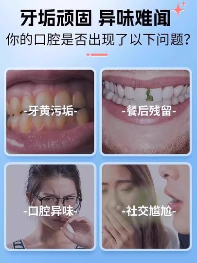 No Need to Rinse! Mouthwash Tablets, Probiotic Solid Toothpaste, All-In-One Teeth Cleaning and Oral Fragrance, a Dating Essential