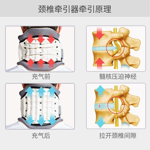 Ланбо шейки матки шейки матки приливная коррекционная терапия для растягивающей надувной медицинской бытовой домашней защитной анти -архи, мужчин и женщин лето