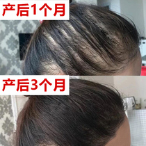 Tongrentang ginger shampoo anti-hair loss rapid hair growth hair growth hair development serious hair loss special hair for women