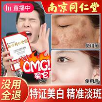 Tongrentang Freckle Mask Official Flagship Store Whitening Water Remove Yellow Dull Freckles