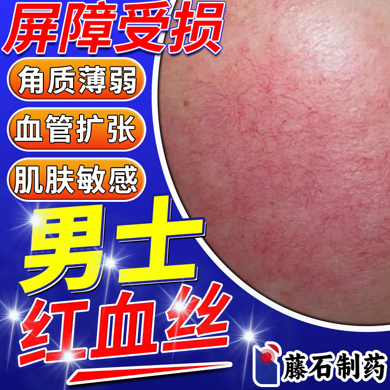 Men's Red Blood Vessel Repair Product Improves Cuticles, Thickens Sensitive Skin, and Repairs Facial Capillary Dilations Men's Red Blood Vessel Repair Product Improves Cuticles, Thickens Sensitive Skin, and Repairs Facial Capillary Dilations