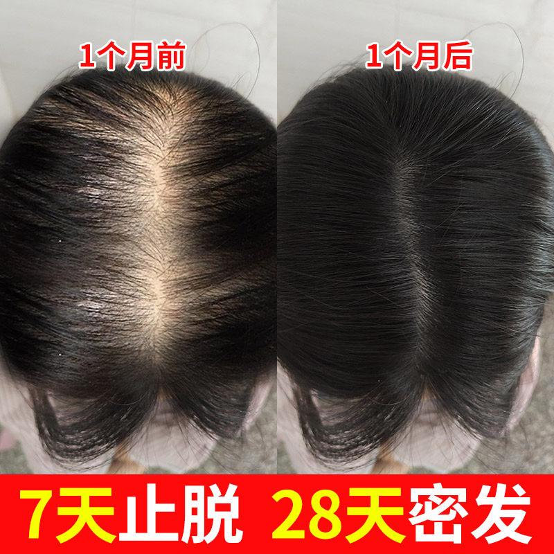 Tongrentang Shengfa Liquid Anti-alopecia Issue Dense Development Essence Hair Line Hair Rapid Growth Hair Agent Artifact