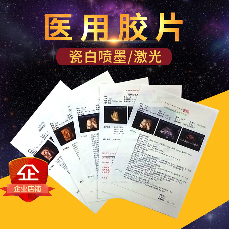 Sencai Medical Negatives Photocopying Paper B Super Four Dimensional Color Super Gastroenteroscopy Porcelain White Inkjet Laser Translucent Adhesive Tape Sheet Paper