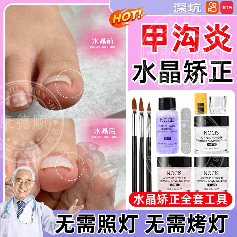 Toe Nail Corrector Ingrown Toenail Set Acrylic Powder Extension Crystal Nail Anti-Fungal Nail Tool Ll Toe Nail Corrector Ingrown Toenail Set Acrylic Powder Extension Crystal Nail Anti-Fungal Nail Tool Ll