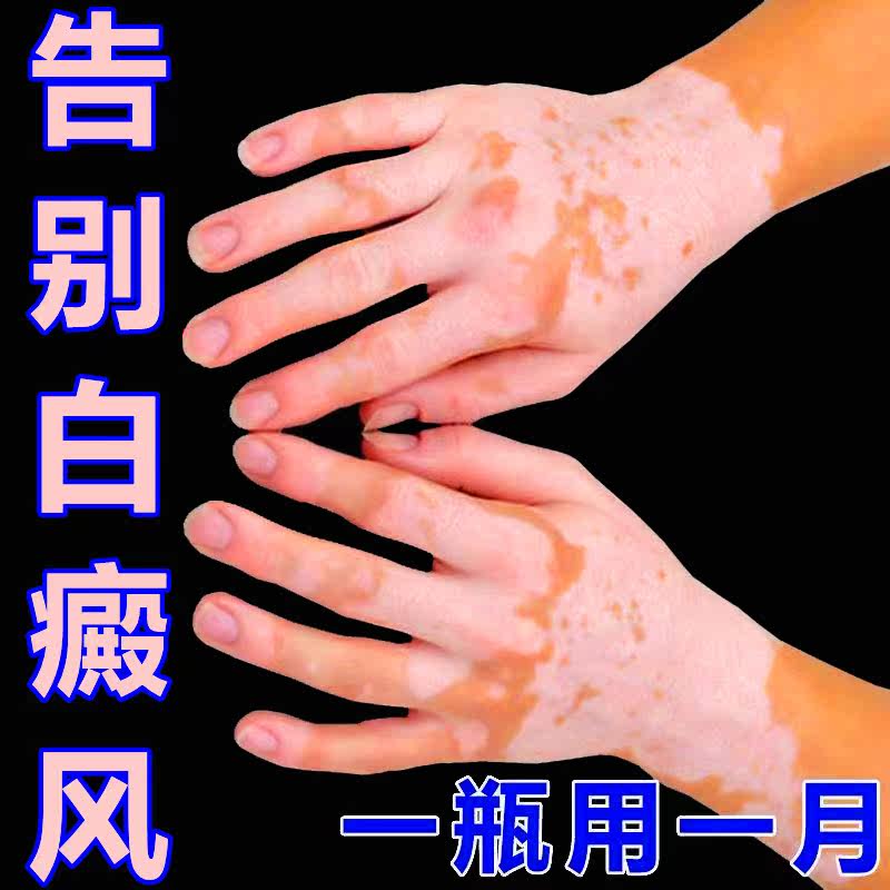 White Purpura Wind Cover Liquid God Lasting Type Waterproof Perspiration White Zebra Color flawless pen cream Cream Hand Face