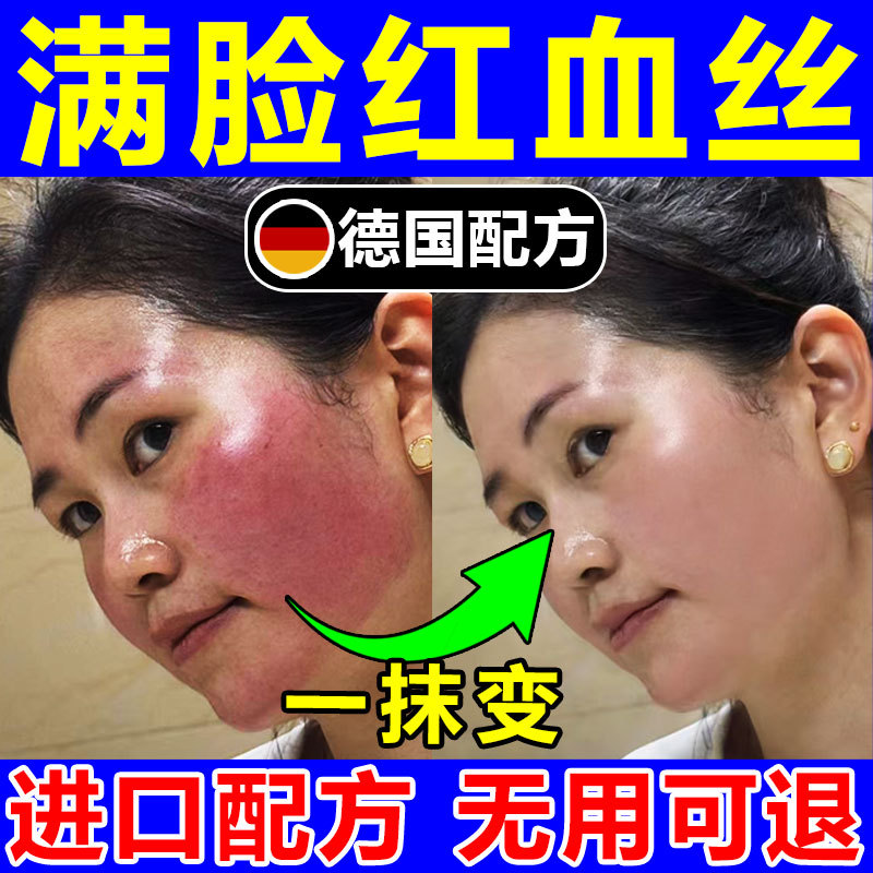 Remove Redness, Repair the Stratum Corneum, Improve Sensitive Skin, Thicken the Face, Reduce Redness, Itchiness, Dryness, and Flaking, Oil-Based Ointment Remove Redness, Repair the Stratum Corneum, Improve Sensitive Skin, Thicken the Face, Reduce Redness, Itchiness, Dryness, and Flaking, Oil-Based Ointment