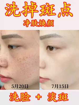 Freckle facial cleanser whitening light spots female men special freckles chloasma desalination melanin oil control moisturizing moisturizing