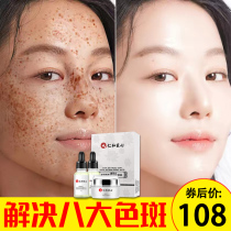  Freckle cream official flagship store freckle melasma artifact men and women whitening light spots old national genetic spots