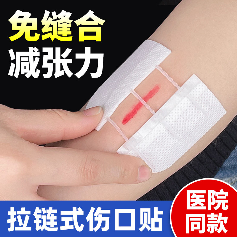拉链式创可贴减张贴免缝合疤痕减张器刨腹产手术成人拉锁抽拉自缝