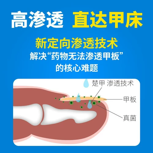 楚甲 Аморофен гидрохлорид линимент 5%*2 мл для лечения онхомикоза о онихомикоза