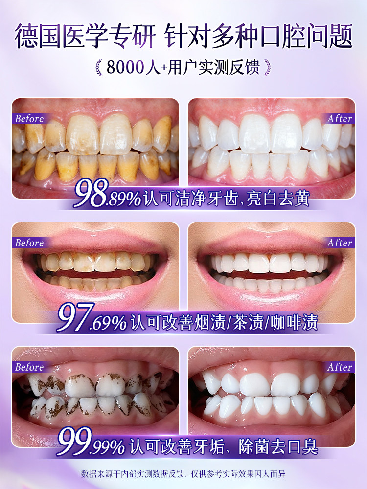 Lysozyme Toothpaste for Adults, Whitening, Removing Yellowing, Removing Bad Breath, Eliminating Odor, Freshening Breath, Anti-Allergic, Anti-Cavity Special